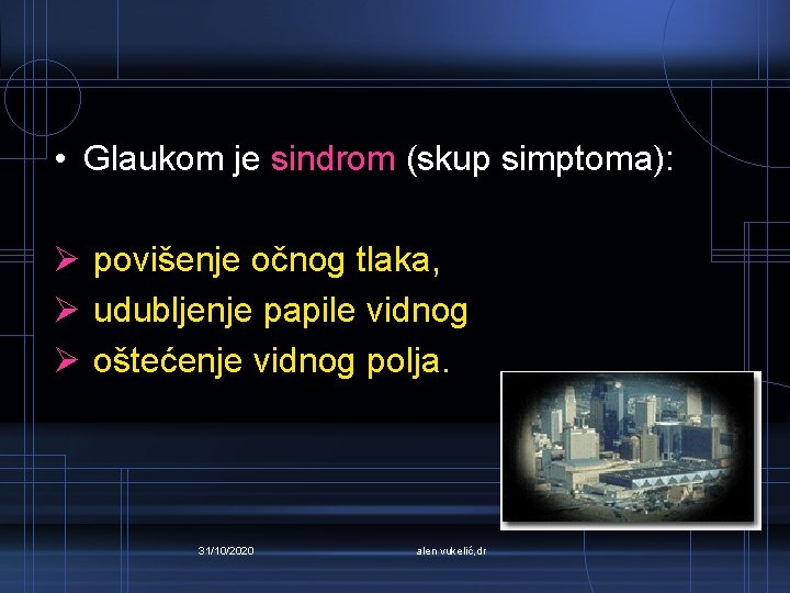  • Glaukom je sindrom (skup simptoma): Ø povišenje očnog tlaka, Ø udubljenje papile