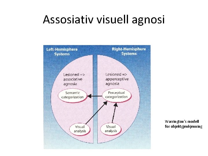 Assosiativ visuell agnosi Warrington’s modell for objektgjenkjenning 