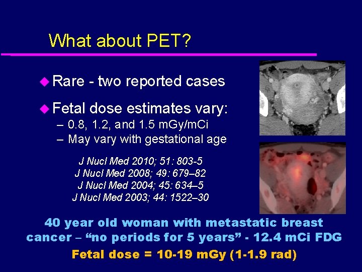 What about PET? u Rare - two reported cases u Fetal dose estimates vary: