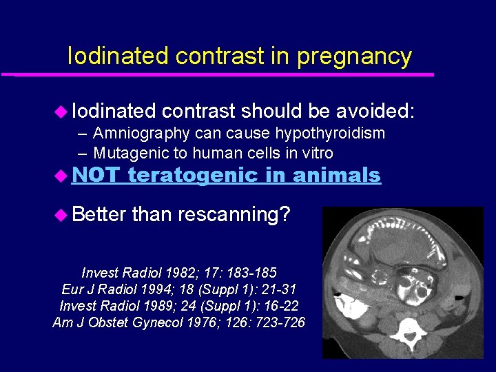 Iodinated contrast in pregnancy u Iodinated contrast should be avoided: – Amniography can cause