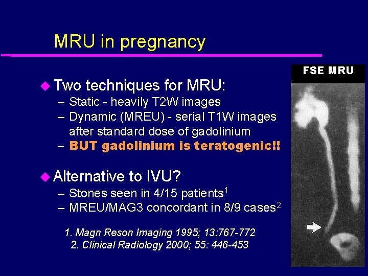 MRU in pregnancy u Two techniques for MRU: – Static - heavily T 2