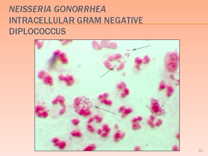 NEISSERIA GONORRHEA INTRACELLULAR GRAM NEGATIVE DIPLOCOCCUS 82 