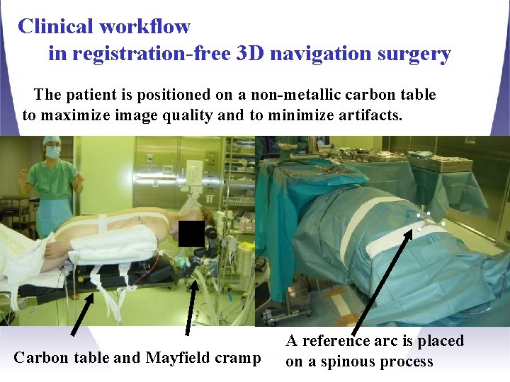 Clinical workflow in registration-free 3 D navigation surgery The patient is positioned on a Clinical workflow in registration-free 3 D navigation surgery The patient is positioned on a