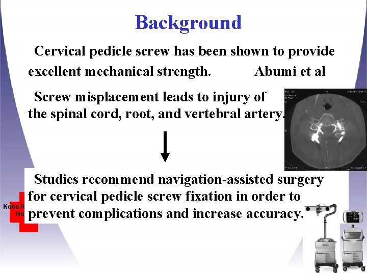 Background Cervical pedicle screw has been shown to provide excellent mechanical strength. Abumi et Background Cervical pedicle screw has been shown to provide excellent mechanical strength. Abumi et