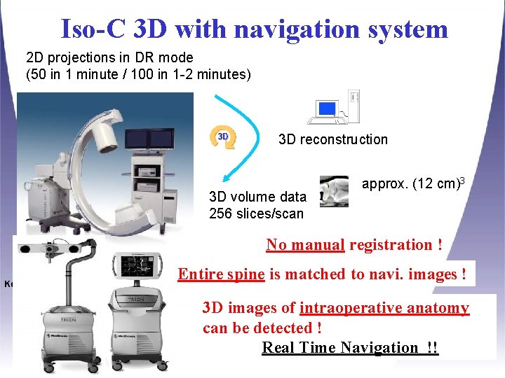 Iso-C 3 D with navigation system 2 D projections in DR mode (50 in Iso-C 3 D with navigation system 2 D projections in DR mode (50 in