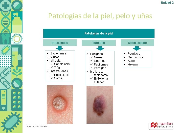 Unidad 2 Patologías de la piel, pelo y uñas Patologías de la piel Infecciosas