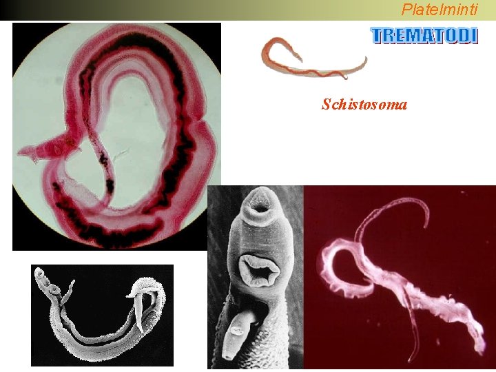 Platelminti Schistosoma 
