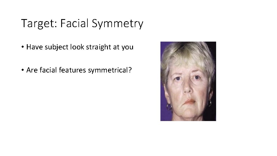 Target: Facial Symmetry • Have subject look straight at you • Are facial features