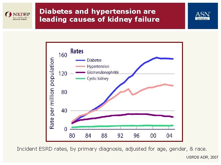 Diabetes and hypertension are leading causes of kidney failure Incident ESRD rates, by primary