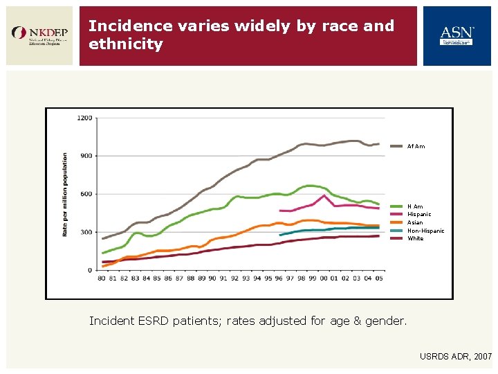 Incidence varies widely by race and ethnicity Rate per million population Af Am N