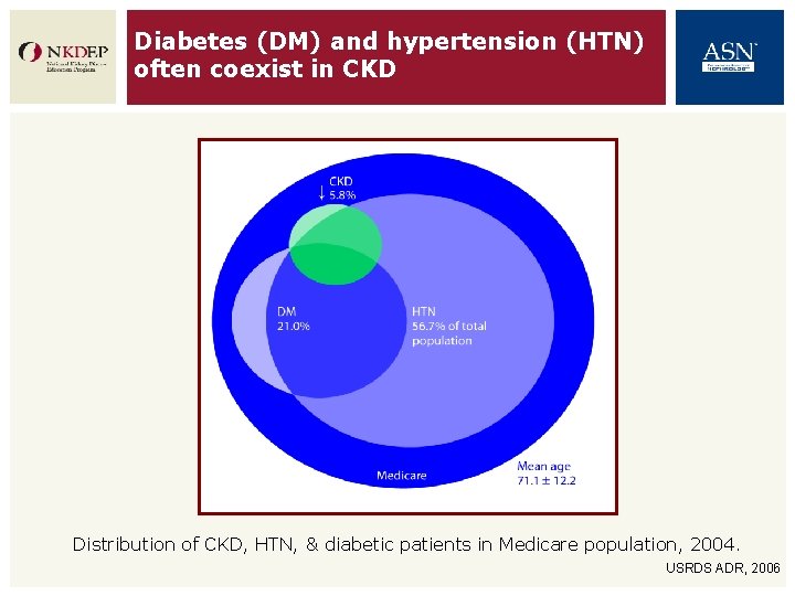 Diabetes (DM) and hypertension (HTN) often coexist in CKD Distribution of CKD, HTN, &