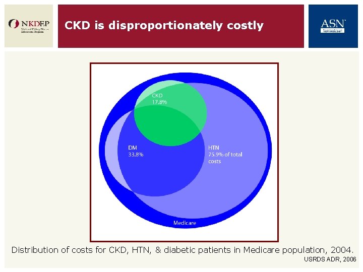 CKD is disproportionately costly Distribution of costs for CKD, HTN, & diabetic patients in