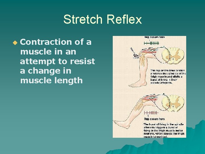 Stretch Reflex u Contraction of a muscle in an attempt to resist a change