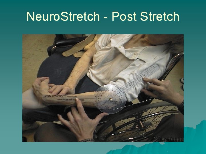 Neuro. Stretch - Post Stretch 