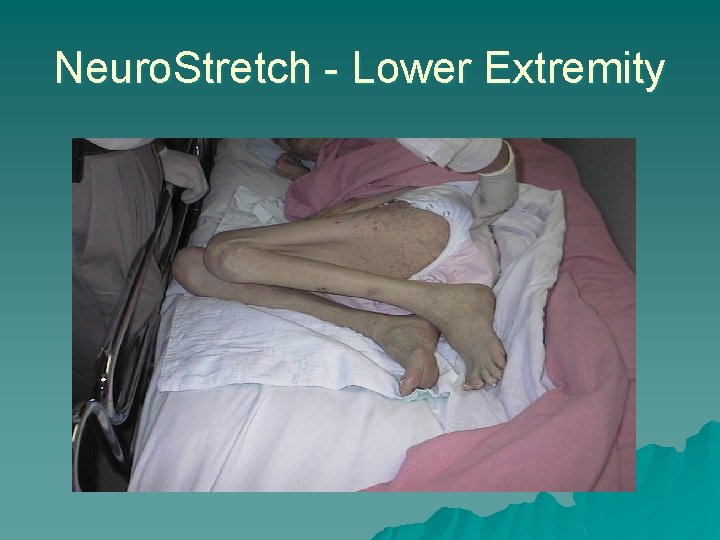 Neuro. Stretch - Lower Extremity 