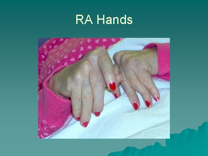 RA Hands 
