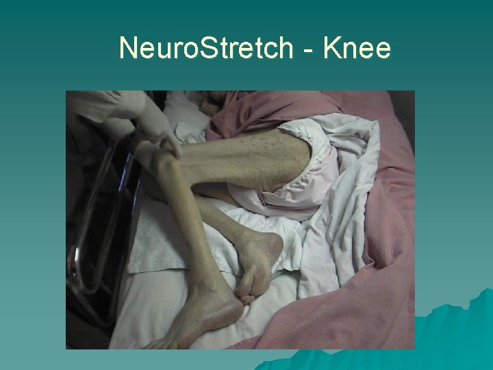 Neuro. Stretch - Knee 