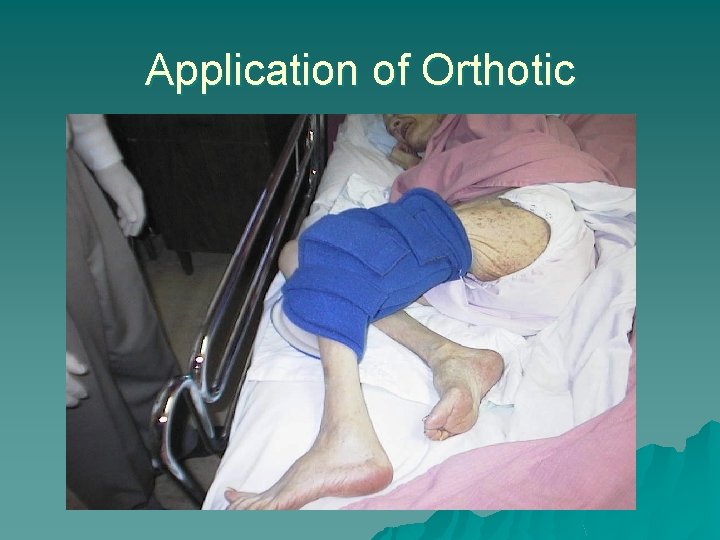 Application of Orthotic 