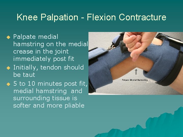 Knee Palpation - Flexion Contracture u u u Palpate medial hamstring on the medial