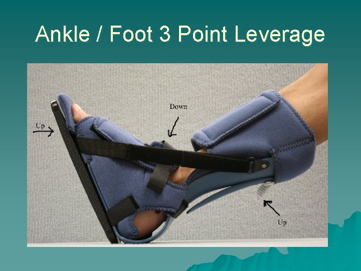 Ankle / Foot 3 Point Leverage 