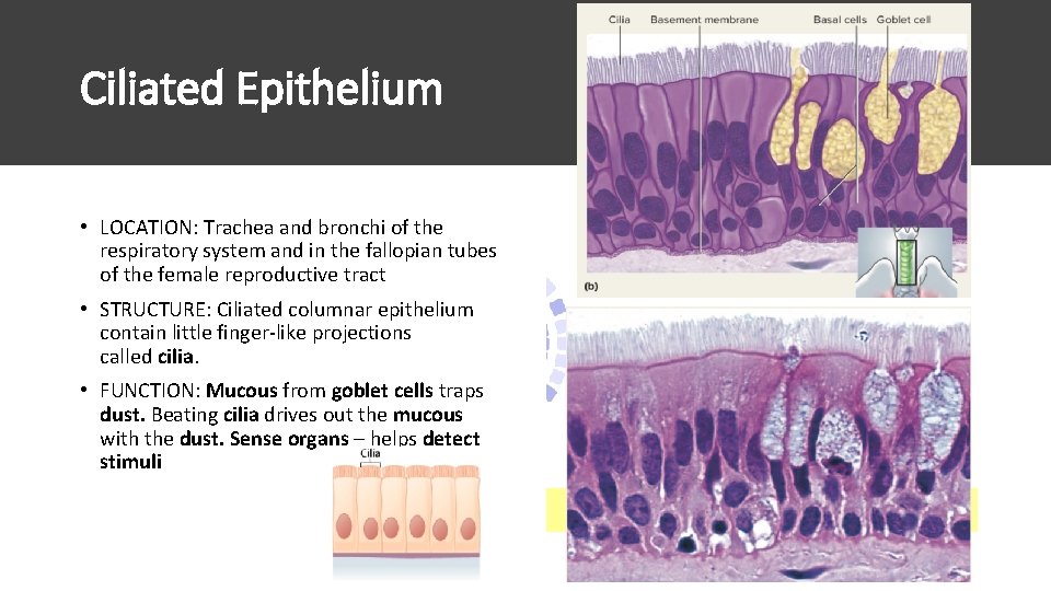 Ciliated Epithelium • LOCATION: Trachea and bronchi of the respiratory system and in the