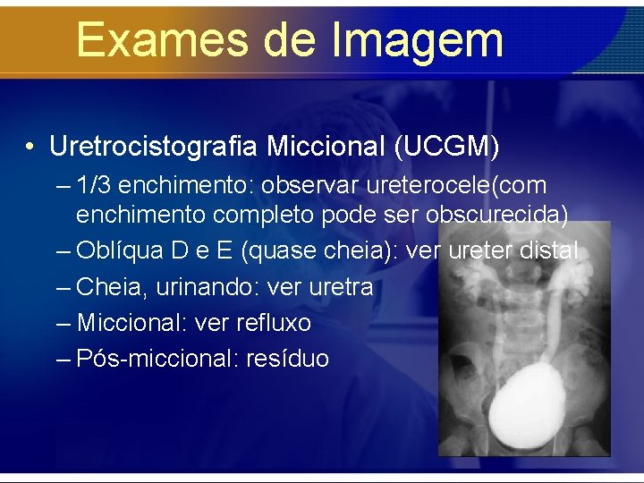Exames de Imagem • Uretrocistografia Miccional (UCGM) – 1/3 enchimento: observar ureterocele(com enchimento completo