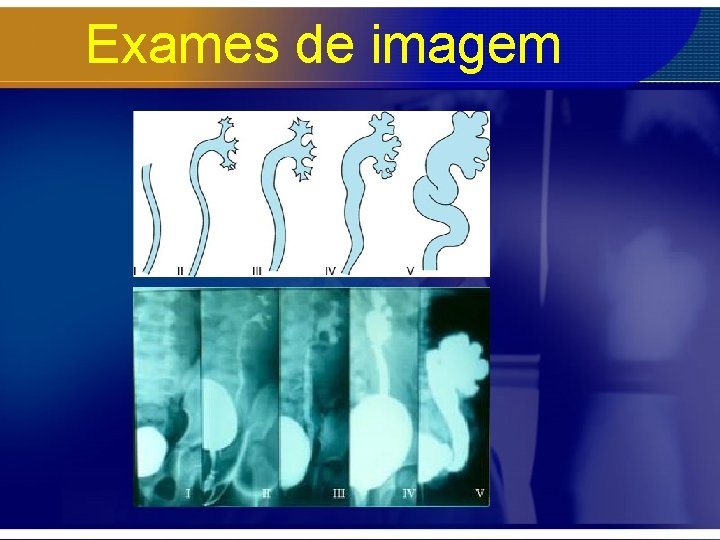 Exames de imagem 