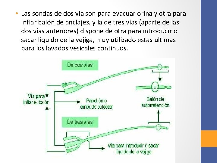  • Las sondas de dos vía son para evacuar orina y otra para