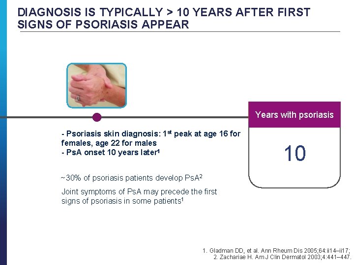 DIAGNOSIS IS TYPICALLY > 10 YEARS AFTER FIRST SIGNS OF PSORIASIS APPEAR Years with