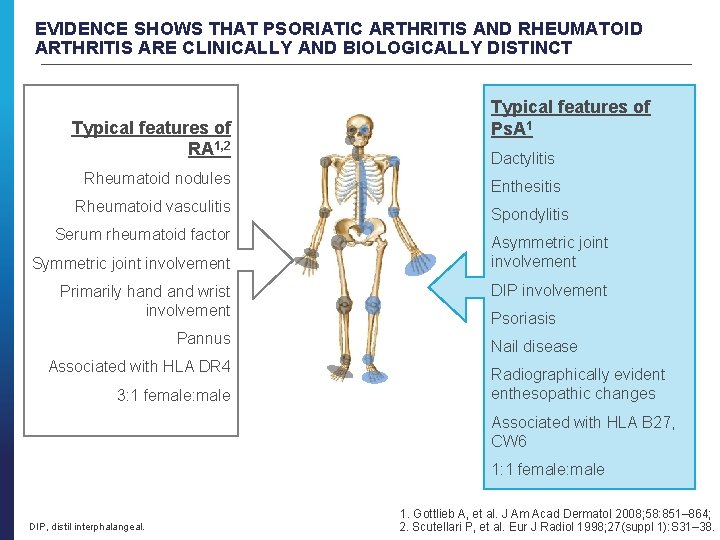 EVIDENCE SHOWS THAT PSORIATIC ARTHRITIS AND RHEUMATOID ARTHRITIS ARE CLINICALLY AND BIOLOGICALLY DISTINCT Typical