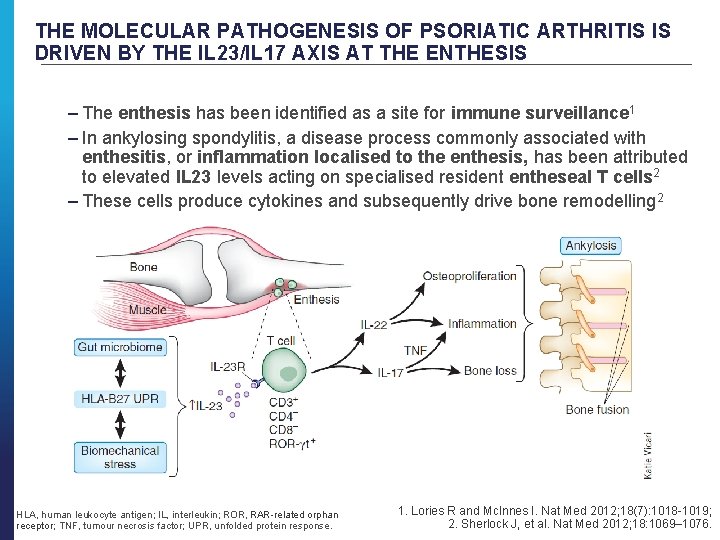 THE MOLECULAR PATHOGENESIS OF PSORIATIC ARTHRITIS IS DRIVEN BY THE IL 23/IL 17 AXIS