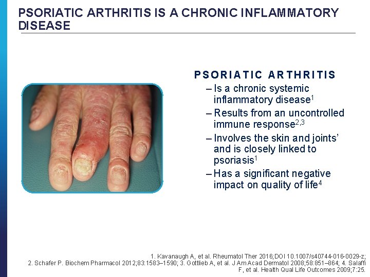 PSORIATIC ARTHRITIS IS A CHRONIC INFLAMMATORY DISEASE PSORIATIC ARTHRITIS – Is a chronic systemic