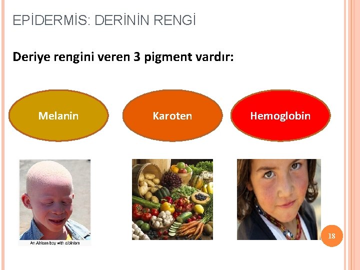 EPİDERMİS: DERİNİN RENGİ Deriye rengini veren 3 pigment vardır: Melanin Karoten Hemoglobin 18 