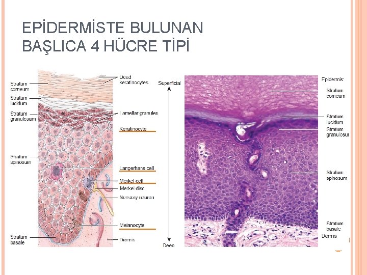 EPİDERMİSTE BULUNAN BAŞLICA 4 HÜCRE TİPİ 10 