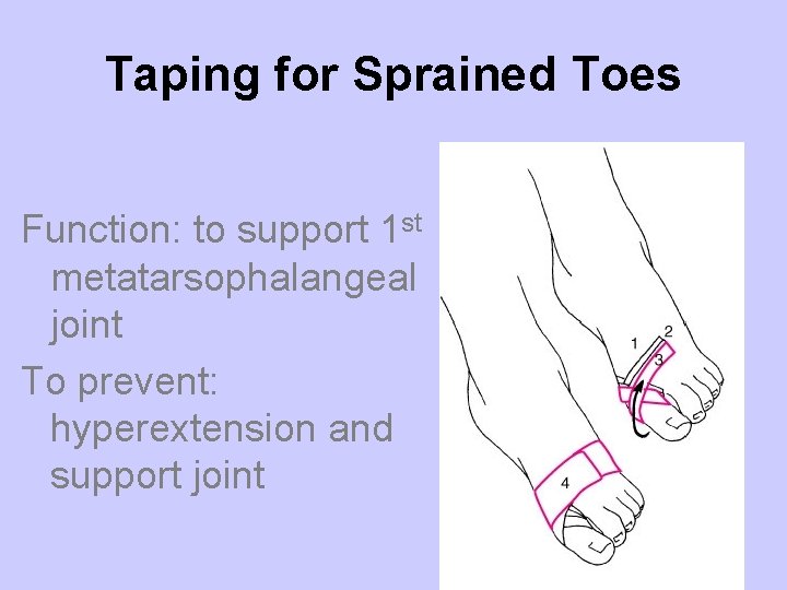Taping for Sprained Toes Function: to support 1 st metatarsophalangeal joint To prevent: hyperextension