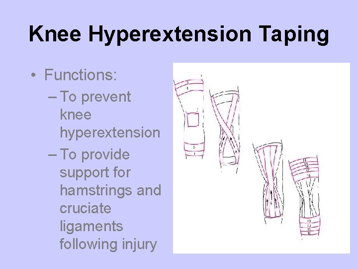 Knee Hyperextension Taping • Functions: – To prevent knee hyperextension – To provide support Knee Hyperextension Taping • Functions: – To prevent knee hyperextension – To provide support
