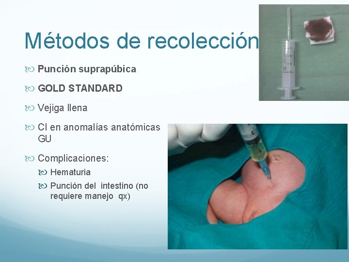 Métodos de recolección Punción suprapúbica GOLD STANDARD Vejiga llena CI en anomalías anatómicas GU Métodos de recolección Punción suprapúbica GOLD STANDARD Vejiga llena CI en anomalías anatómicas GU