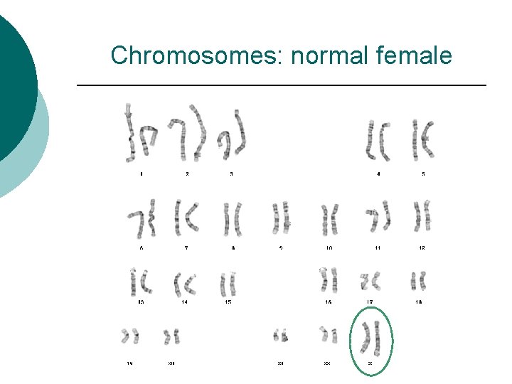Chromosomes: normal female 