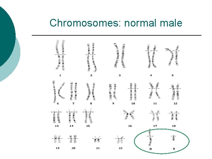 Chromosomes: normal male 