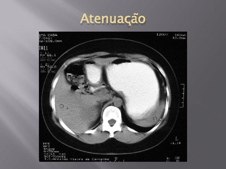 Atenuação 