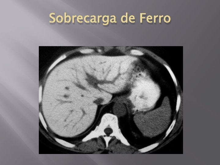 Sobrecarga de Ferro 