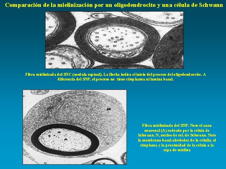Comparación de la mielinización por un oligodendrocito y una célula de Schwann Fibra mielinizada