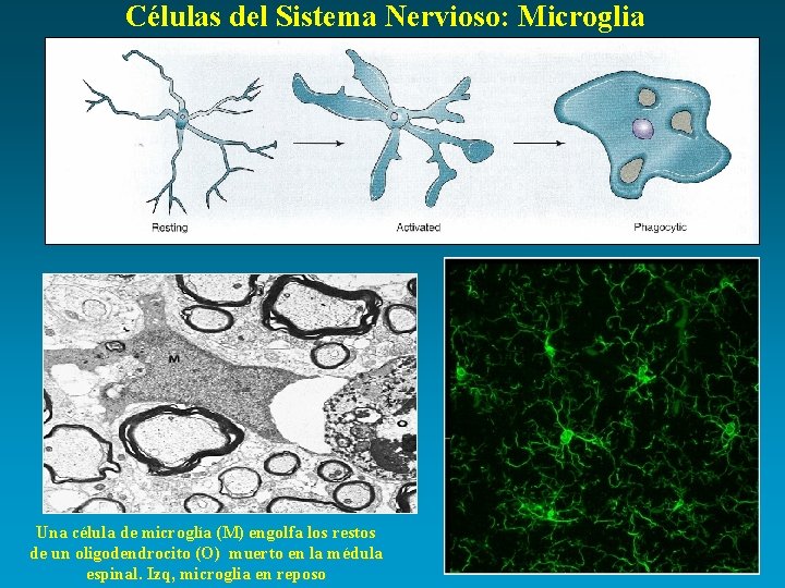 Células del Sistema Nervioso: Microglia Una célula de microglía (M) engolfa los restos de