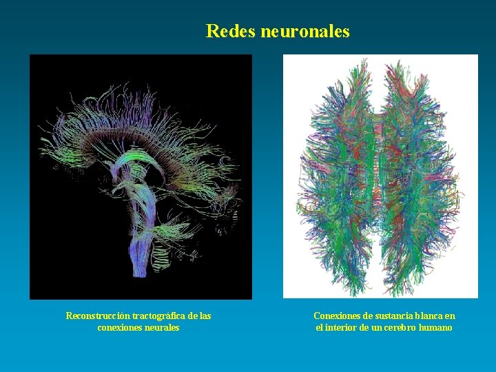 Redes neuronales Reconstrucción tractográfica de las conexiones neurales Conexiones de sustancia blanca en el