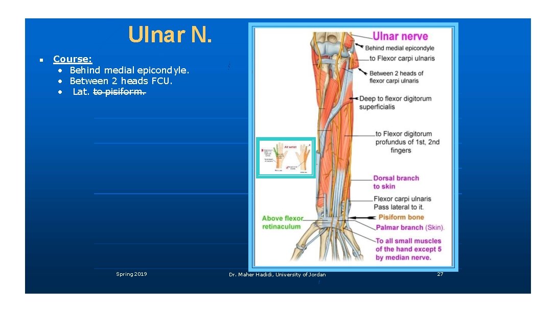 Ulnar N. Course: • Behind medial epicondyle. • Between 2 heads FCU. • Lat.