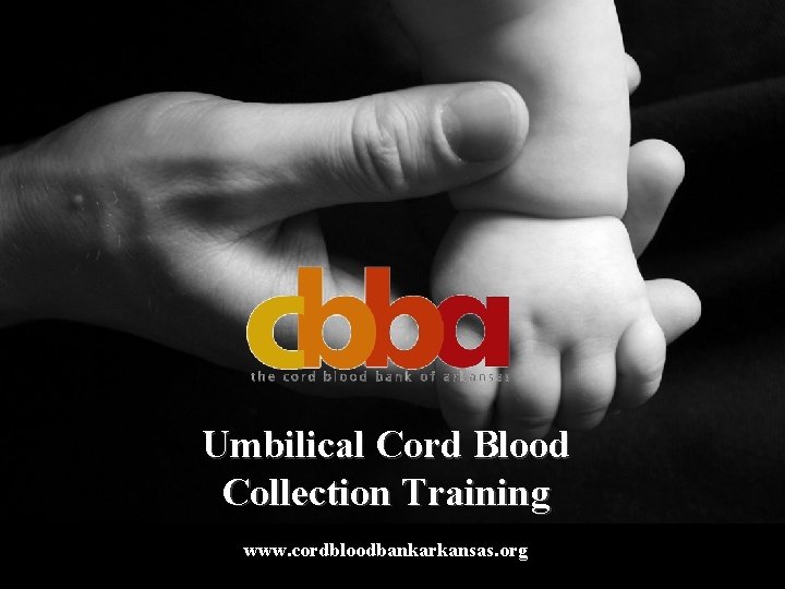 Umbilical Cord Blood Collection Training www. cordbloodbankarkansas. org 