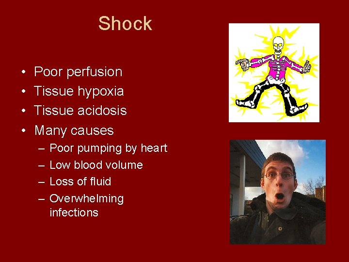 Shock • • Poor perfusion Tissue hypoxia Tissue acidosis Many causes – – Poor