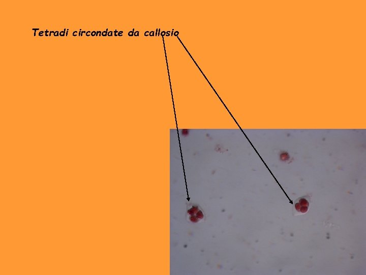 Tetradi circondate da callosio 