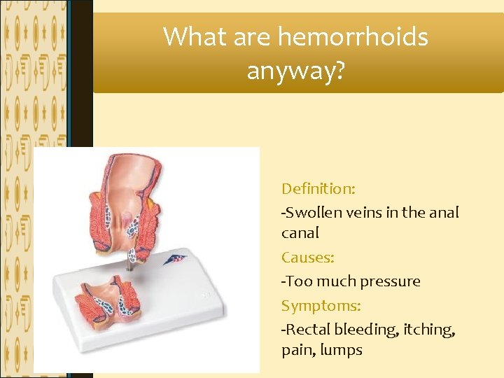 What are hemorrhoids anyway? Definition: -Swollen veins in the anal canal Causes: -Too much What are hemorrhoids anyway? Definition: -Swollen veins in the anal canal Causes: -Too much