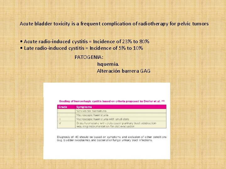 Acute bladder toxicity is a frequent complication of radiotherapy for pelvic tumors • Acute